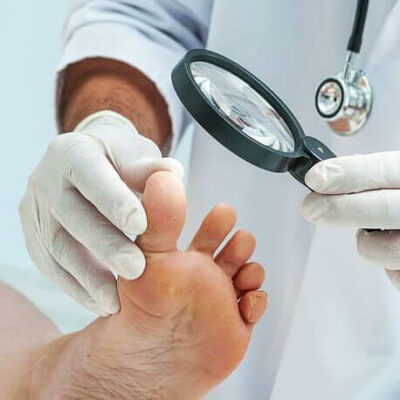 leczenie palca cukrzycowego